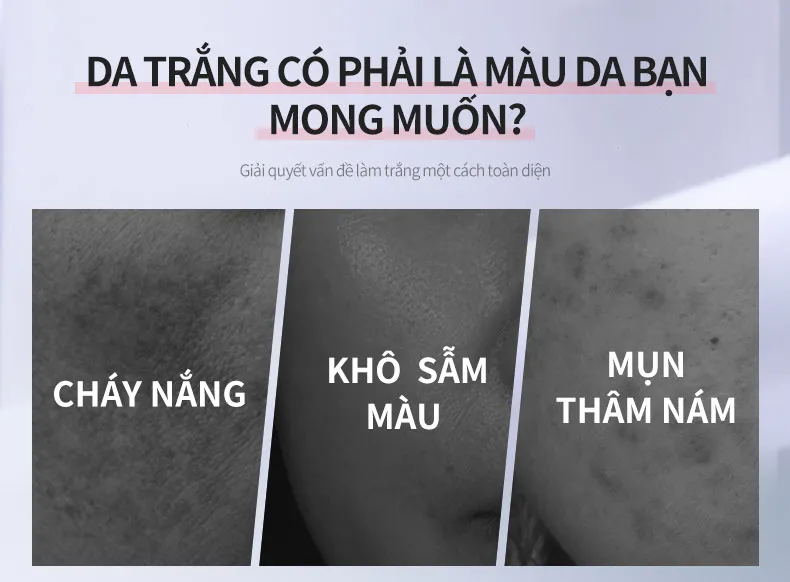 Ảnh thu nhỏ