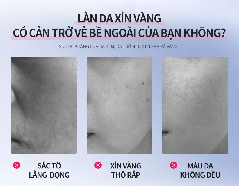Ảnh thu nhỏ