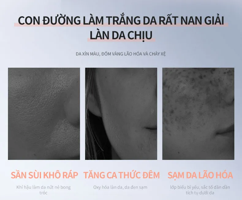 Ảnh thu nhỏ