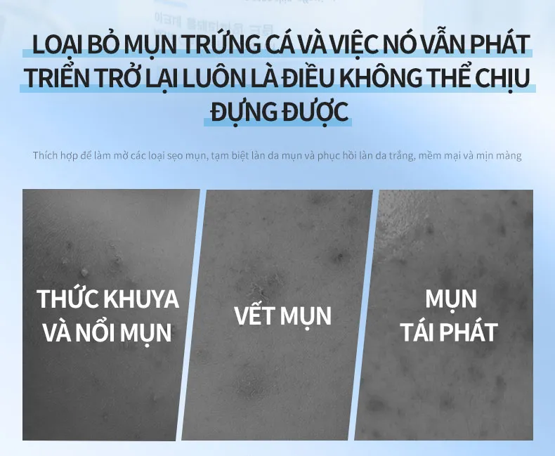 Ảnh thu nhỏ