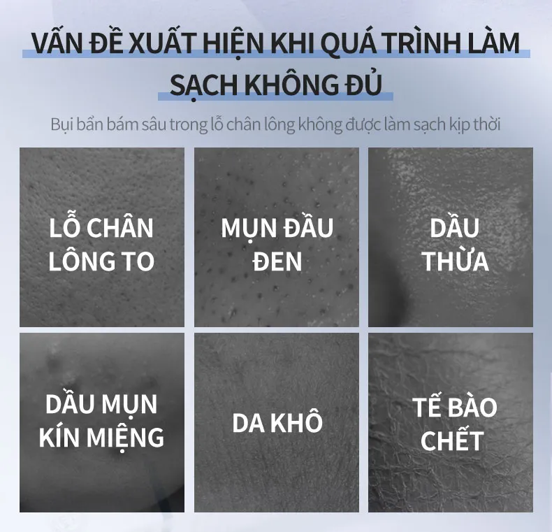 Ảnh thu nhỏ
