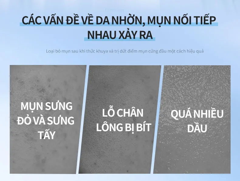 Ảnh thu nhỏ
