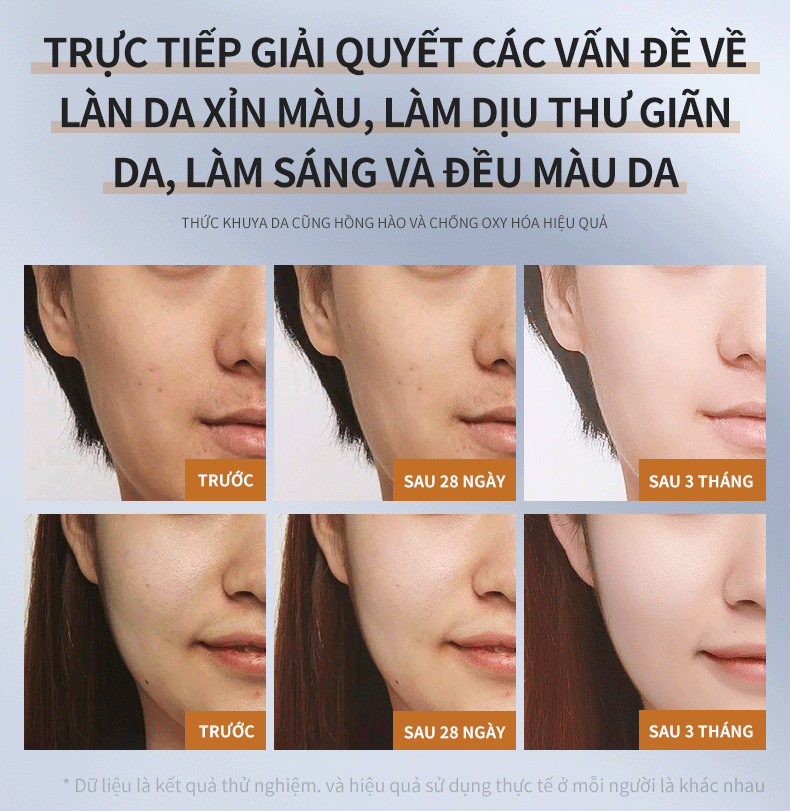 Ảnh thu nhỏ