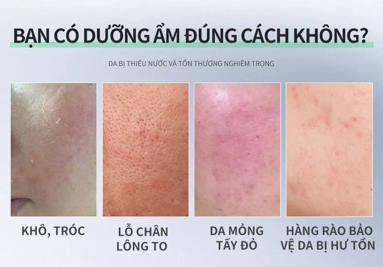 Ảnh thu nhỏ