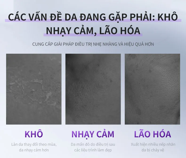 Ảnh thu nhỏ