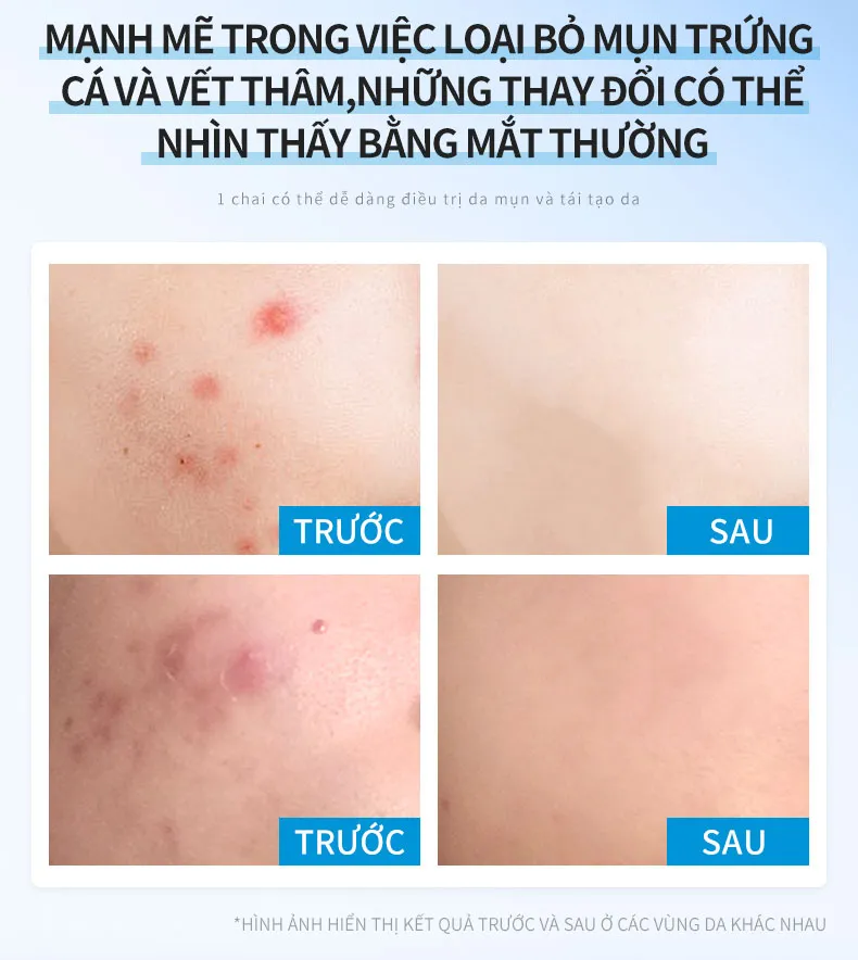 Ảnh thu nhỏ