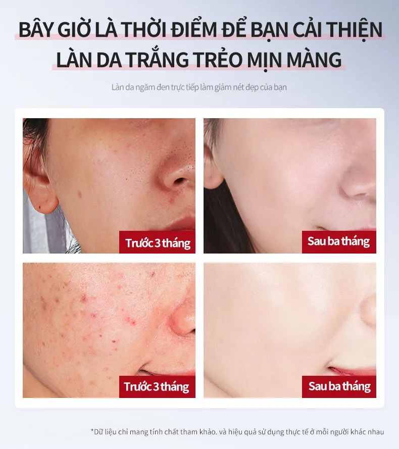 Ảnh thu nhỏ