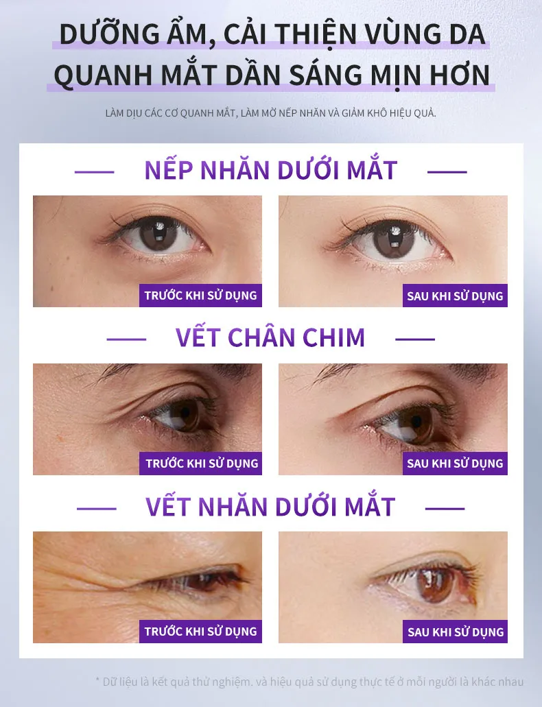 Ảnh thu nhỏ