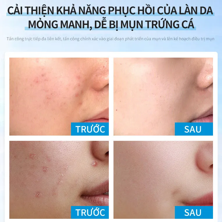 Ảnh thu nhỏ