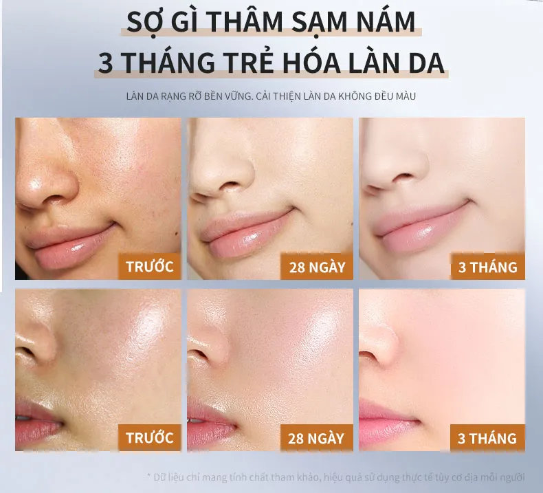 Ảnh thu nhỏ