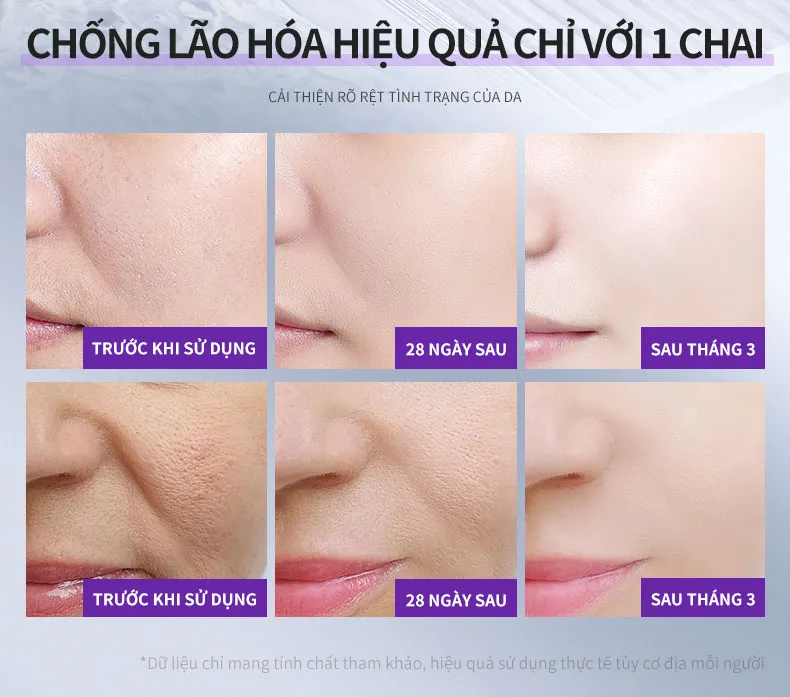 Ảnh thu nhỏ