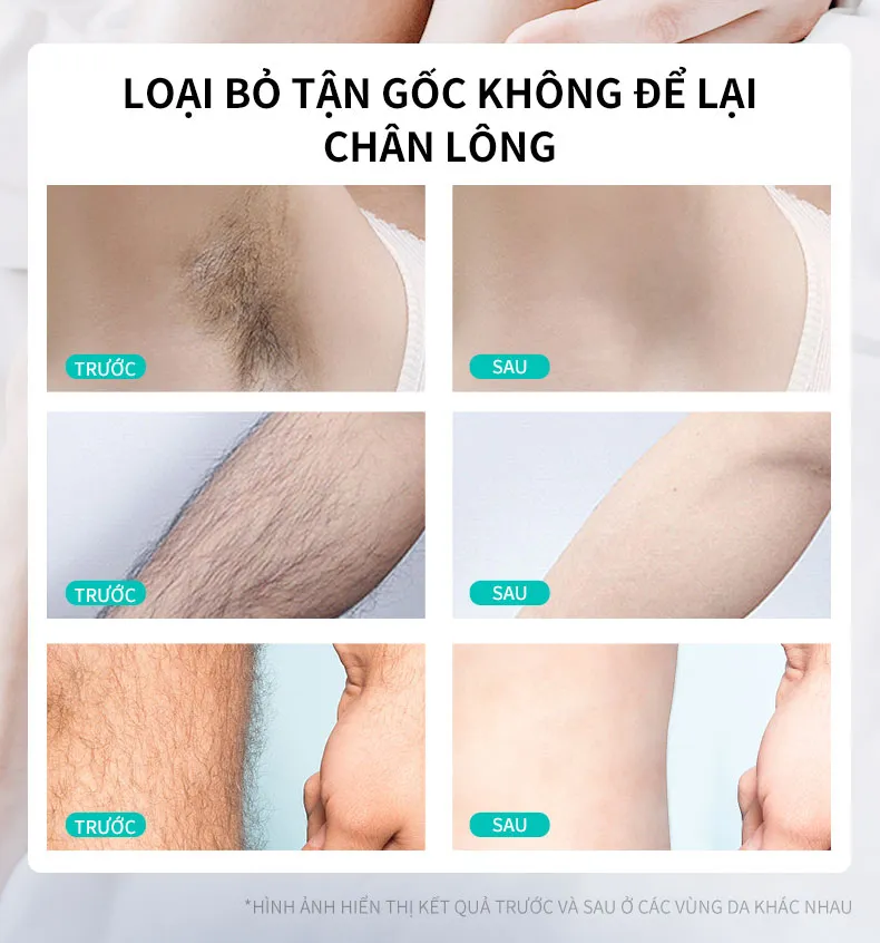 Ảnh thu nhỏ