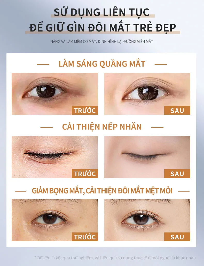 Ảnh thu nhỏ