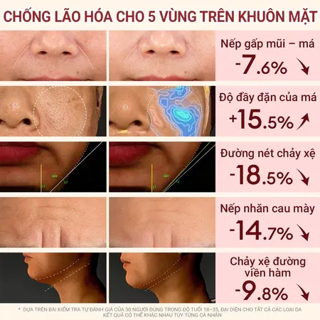 Ảnh thu nhỏ