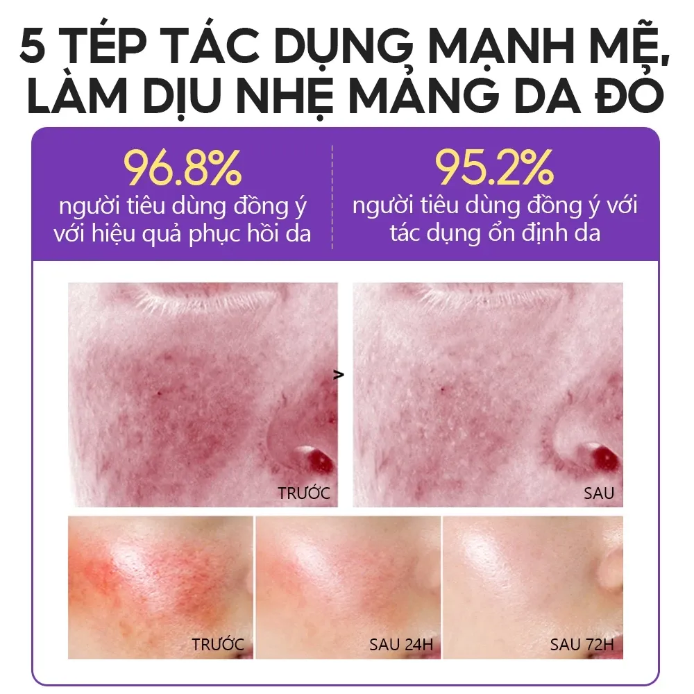 Ảnh thu nhỏ