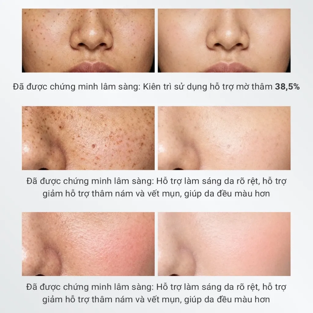 Ảnh thu nhỏ