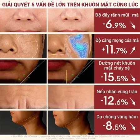 Ảnh thu nhỏ