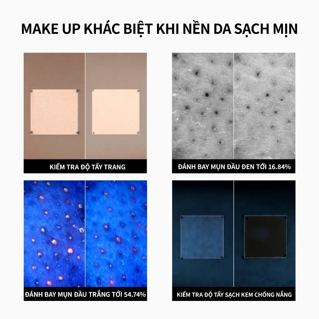 Ảnh thu nhỏ