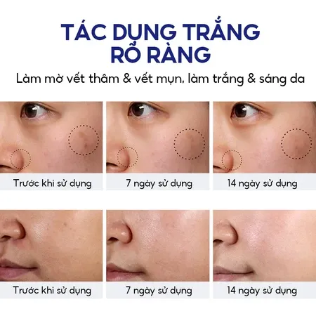 Ảnh thu nhỏ