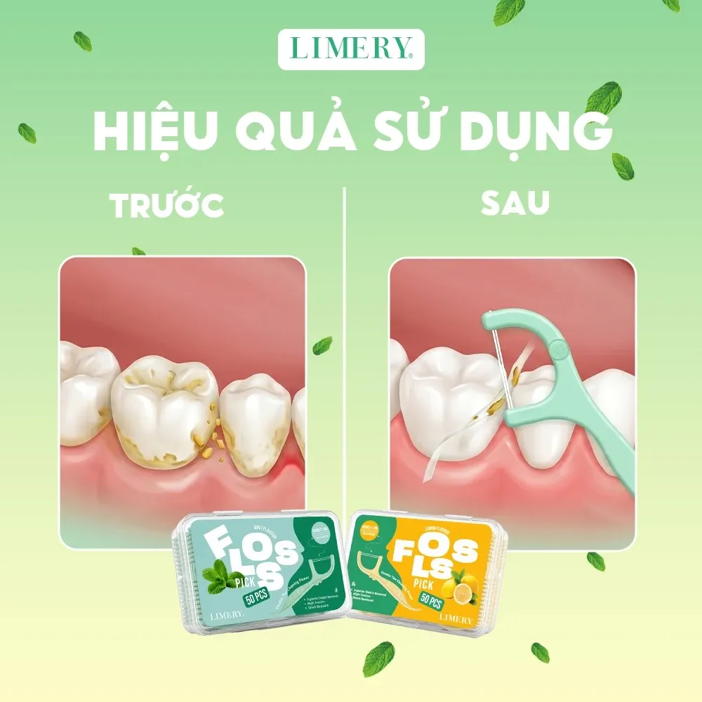 Ảnh thu nhỏ