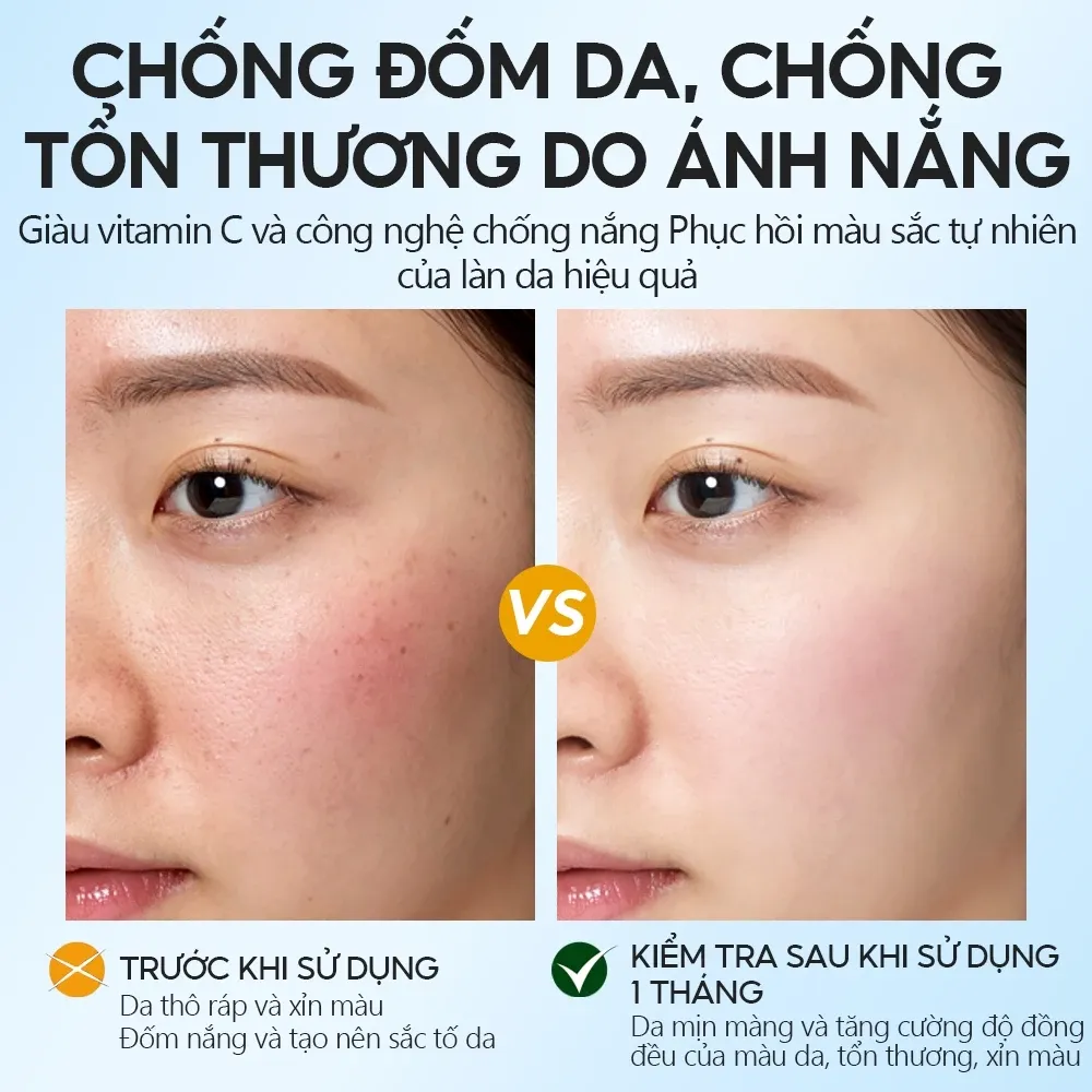 Ảnh thu nhỏ